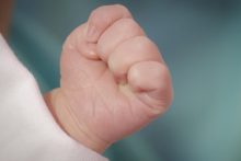 neonatologia-setembro-verde-esperanca-asfixia-perinatal