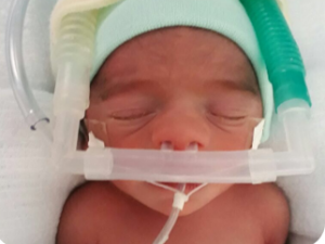 suporte-respiratorio-cpap-neonatal