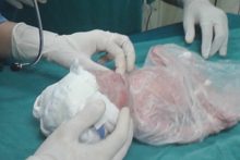 neonatologia-prematuro