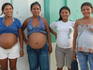 arboviroses-gestante-obstetricia