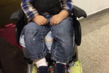 pediatria-deficiencia-infantil