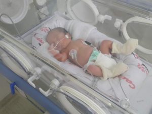 cardiopatia-congenita-neonatal