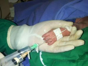 terapia-intravenosa-pediatria