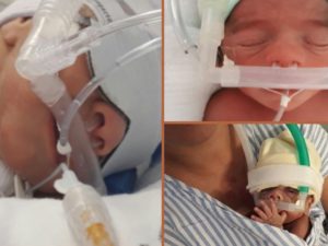 cpap-nasal