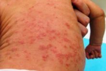 pediatria-
