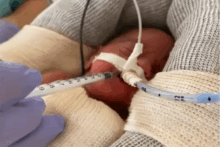 neonatologia-