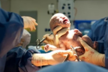 neonatologia-